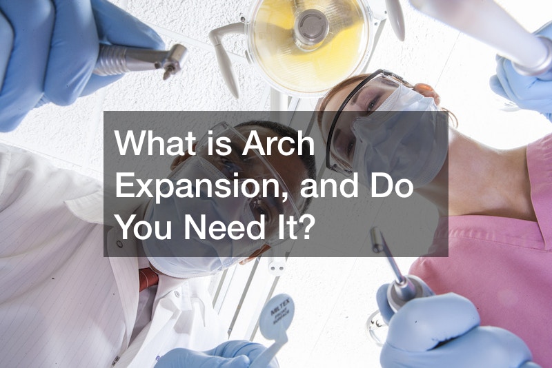 What is Arch Expansion, and Do You Need It?