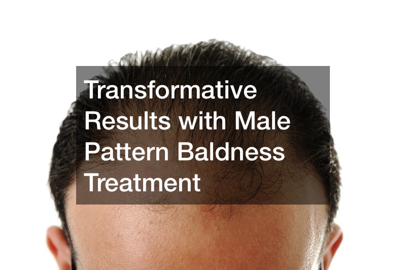 Transformative Results with Male Pattern Baldness Treatment